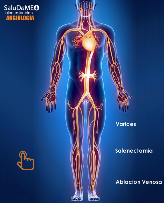 Laser Diodo Quirurgico Angiologia y Cirugia Vascular